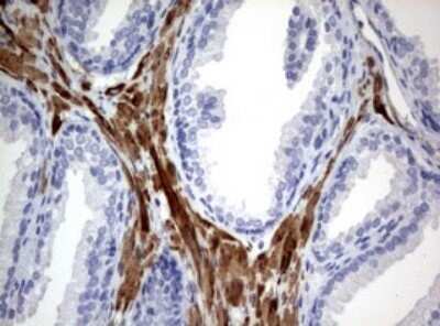 Immunohistochemistry: TSC1 Antibody (OTI3A2) - Azide and BSA Free [NBP2-74653]
