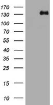 Western Blot: TSC1 Antibody (OTI3A2)Azide and BSA Free [NBP2-74653]