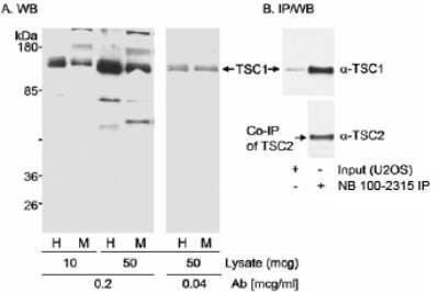 Western Blot: TSC1 Antibody [NB100-2315]