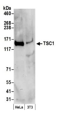 Western Blot: TSC1 Antibody [NB100-2315]