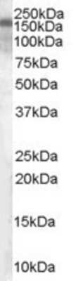 Western Blot: TSC1 Antibody [NB100-2821]