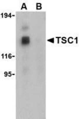 Western Blot: TSC1 AntibodyBSA Free [NBP1-76618]