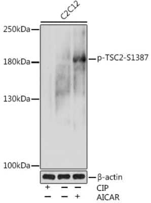 Western Blot: TSC2 [p Ser1387] AntibodyAzide and BSA Free [NBP3-16925]