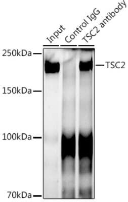 Immunoprecipitation: TSC2 Antibody (7X2C6) [NBP3-15763]