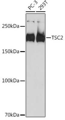 Western Blot: TSC2 Antibody (7X2C6) [NBP3-15763]