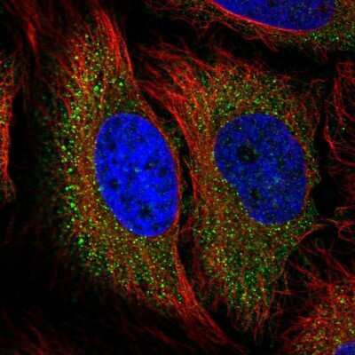 Immunocytochemistry/ Immunofluorescence: TSC2 Antibody [NBP2-56083]