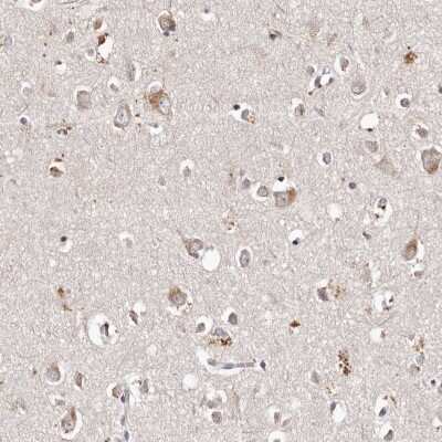 Immunohistochemistry-Paraffin: TSC2 Antibody [NBP1-82849]
