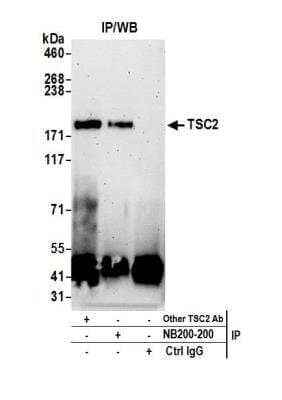 Immunoprecipitation: TSC2 Antibody [NB200-200]