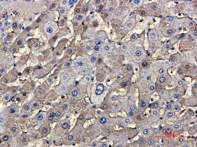 Immunohistochemistry: TSC2 Antibody (S06-0D3) [NBP3-14981]