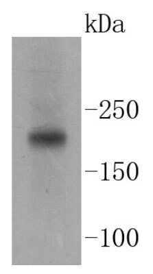 Western Blot: TSC2 Antibody (SC05-59) [NBP2-67552]
