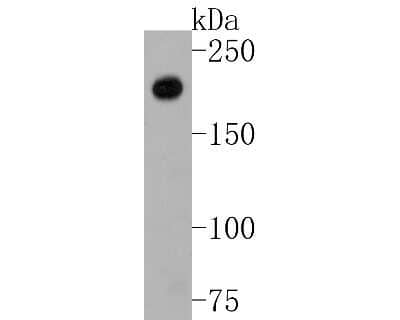 Western Blot: TSC2 Antibody (SC05-59) [NBP2-67552]