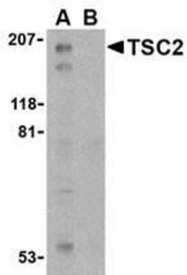 Western Blot: TSC2 AntibodyBSA Free [NBP1-76430]