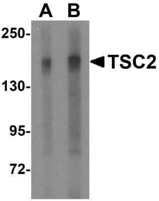 Western Blot: TSC2 AntibodyBSA Free [NBP1-76619]