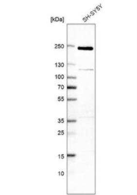 Western Blot: TSC2 Antibody [NBP1-82849]