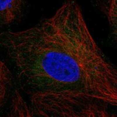 Immunocytochemistry/ Immunofluorescence: TSC21 Antibody [NBP3-17634]