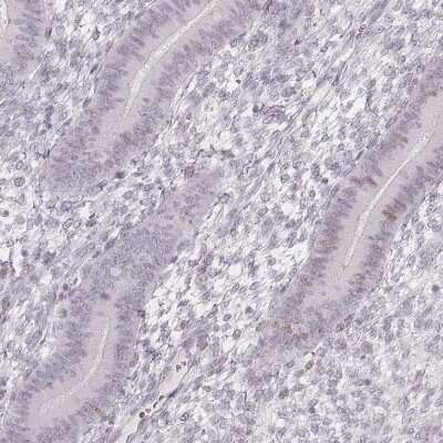 Immunohistochemistry-Paraffin: TSC21 Antibody [NBP1-91727]