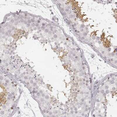 Immunohistochemistry-Paraffin: TSC21 Antibody [NBP1-91727]