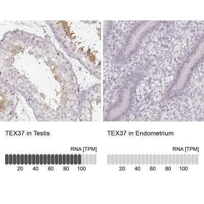 Immunohistochemistry-Paraffin: TSC21 Antibody [NBP1-91727]