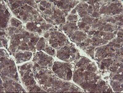 Immunohistochemistry: TSC22/TSC22D1 Antibody (OTI4H8) [NBP2-46238]