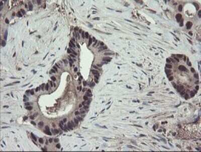 Immunohistochemistry: TSC22/TSC22D1 Antibody (OTI4H8) [NBP2-46238]
