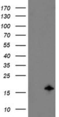 Western Blot: TSC22/TSC22D1 Antibody (OTI4H8) [NBP2-46238]