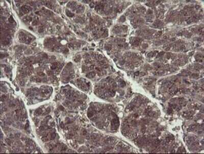 Immunohistochemistry: TSC22/TSC22D1 Antibody (OTI4H8) - Azide and BSA Free [NBP2-74654]