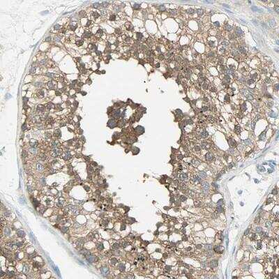 Immunohistochemistry-Paraffin: TSC22D2 Antibody [NBP1-81491]