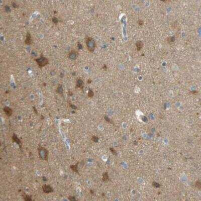 Immunohistochemistry-Paraffin: TSC22D2 Antibody [NBP1-81491]