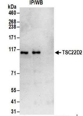 Immunoprecipitation: TSC22D2 Antibody [NBP2-32118]