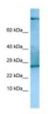 Western Blot: TSC22D2 Antibody [NBP1-98342]