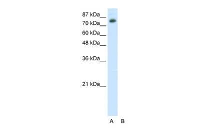 Western Blot: TSC22D2 Antibody [NBP2-88499]