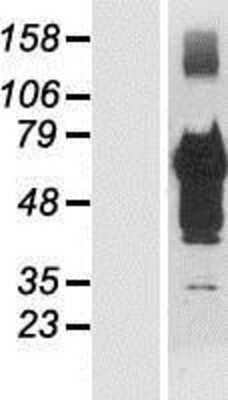 Western Blot: TSC22D4 Overexpression Lysate [NBP2-06160]