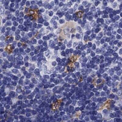 Immunohistochemistry-Paraffin: TSCOT Antibody [NBP2-48543]