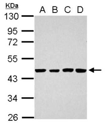 Western Blot: TSCOT Antibody [NBP2-15147]