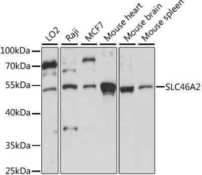 Western Blot: TSCOT AntibodyAzide and BSA Free [NBP2-93061]