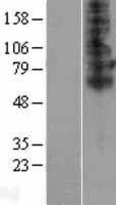 Western Blot: TSCOT Overexpression Lysate [NBP2-05926]