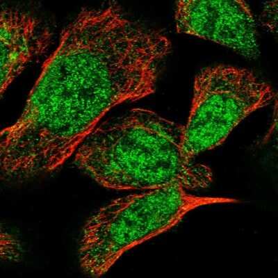 Immunocytochemistry/ Immunofluorescence: TSEN2 Antibody [NBP1-81140]