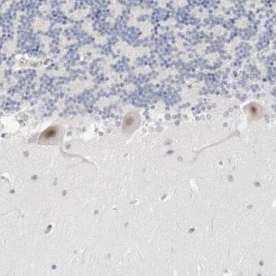 Immunohistochemistry-Paraffin: TSEN2 Antibody [NBP1-81140]