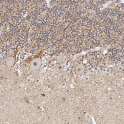 Immunohistochemistry-Paraffin: TSEN2 Antibody [NBP1-81142]