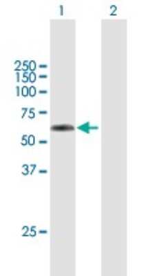 Western Blot: TSEN2 Antibody [H00080746-B01P]