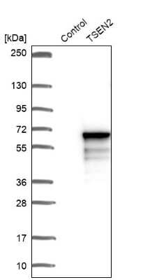 Western Blot: TSEN2 Antibody [NBP1-81140]