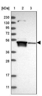 Western Blot: TSEN2 Antibody [NBP1-81141]