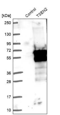 Western Blot: TSEN2 Antibody [NBP1-81142]