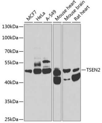 Western Blot: TSEN2 AntibodyBSA Free [NBP2-94310]
