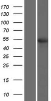 Western Blot: TSEN2 Overexpression Lysate [NBP2-06223]