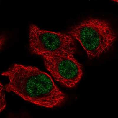 Immunocytochemistry/ Immunofluorescence: TSEN34 Antibody [NBP2-56427]