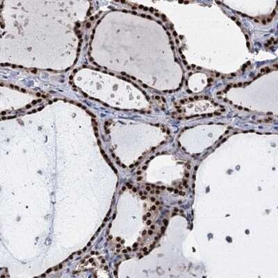 Immunohistochemistry-Paraffin: TSEN34 Antibody [NBP1-81315]