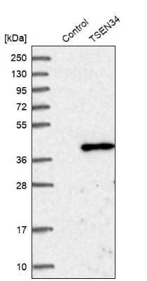 Western Blot: TSEN34 Antibody [NBP1-81315]