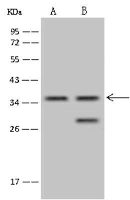 Western Blot: TSEN34 Antibody [NBP2-98554]