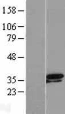 Western Blot: TSEN34 Overexpression Lysate [NBL1-17356]